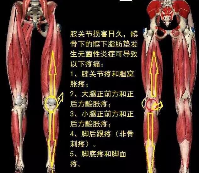 大腿膝盖疼痛是怎么回事 - 汇30资讯