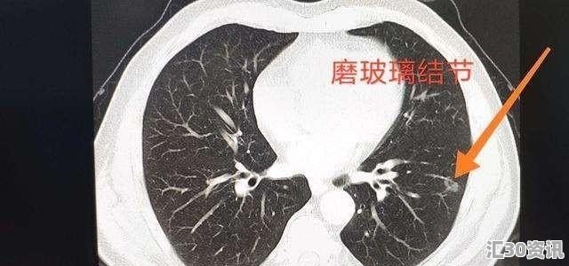 肺部有结节，还经常痛，该怎么办 - 资讯网